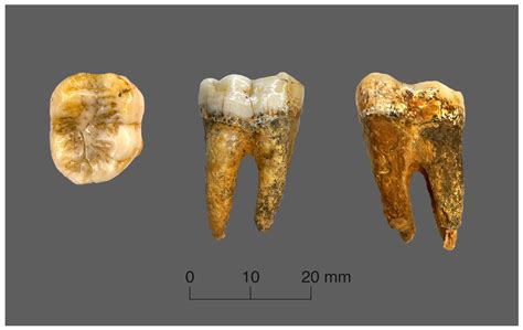 measurement of tooth enamel thickness|chemical name of tooth enamel.